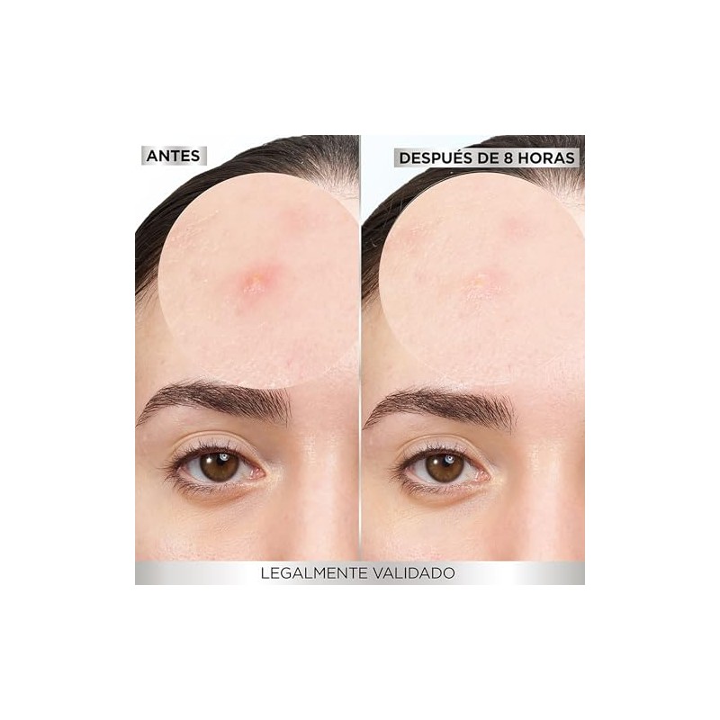 Garnier Pimple Patch Invisible, Parches Hidrocoloides Para Acné, Reduce Imperfecciones