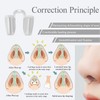 Nostril Retainer - Nose Internal Support Protector for Brace Fracture,