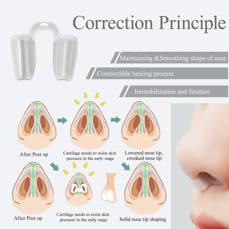 Nostril Retainer - Nose Internal Support Protector for Brace Fracture,
