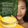 Llama Mama- Peruvian Gold Blsamo curativo orgnico multiusos Cicatrices, eczema,