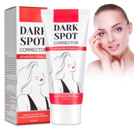 Instant Freckle Cream, Whitening Freckle Cream, Dark Spot Remover Cream, Dark Spot Corrector Remover, Reduces Melasma, Freckles and Sunspots - Red