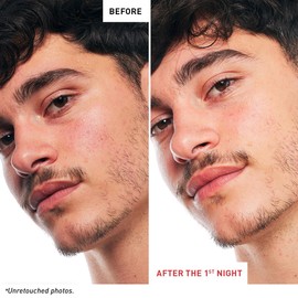 Skin Therapy Multi-Perfecting Bi-Phase Night Oil-Serum - Supercharged With 17 Ingredients -Targets 7 Skin Concerns - Improves Appearance of Fine Lines, Skin Texture and Complexion Evenness (1 Fl Oz)