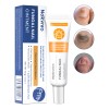Pomada Antifúngica Para Uñas 30g,tratamiento Contra Hongos