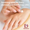 Diprobase Advanced New Formula for Eczema Prone Skin for Red,