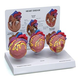 GPI Anatomicals - 3-Piece Mini Heart Model Set, Normal and Diseased Heart Models for Anatomy and Physiology Education, Anatomy Model for Doctor's Office and Classrooms, Medical Learning Resources