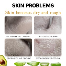 Urea Cream 60 Percent - Urea Foot Cream for Cracked Heels and Dry Skin - Repair Balm for Feet & Hands - 60% Urea Foot Moisturizer for Women,Men - Softening Dry Feet Skin Care Cream 2PCS