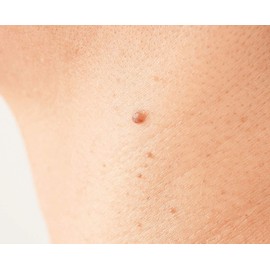 adorn tucker gel patch while sleeping