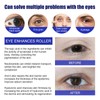 Eye Treatment Roller Relieve eye fatigue and discomfortFade dark circlesPigmented