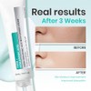 Set Crema Facial Bruma Ácido Hialurónico Pdrn Hidratación Profunda Rejuvenecimiento