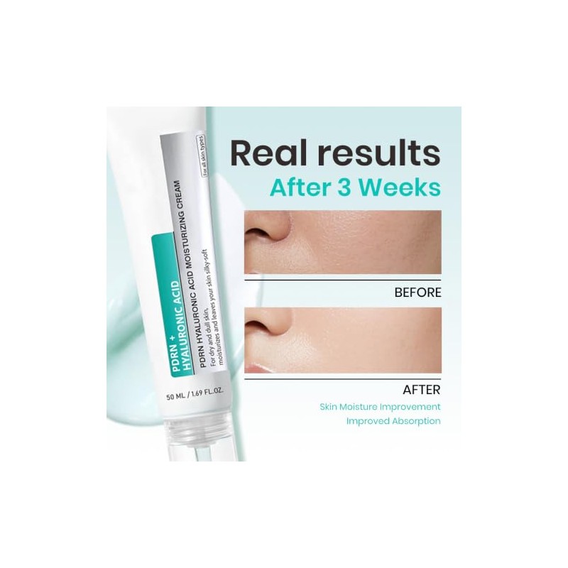Set Crema Facial Bruma Ácido Hialurónico Pdrn Hidratación Profunda Rejuvenecimiento
