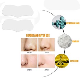 Blackhead Remover Nose Face Mask Strips Black Head Pore Acne Clean-X10