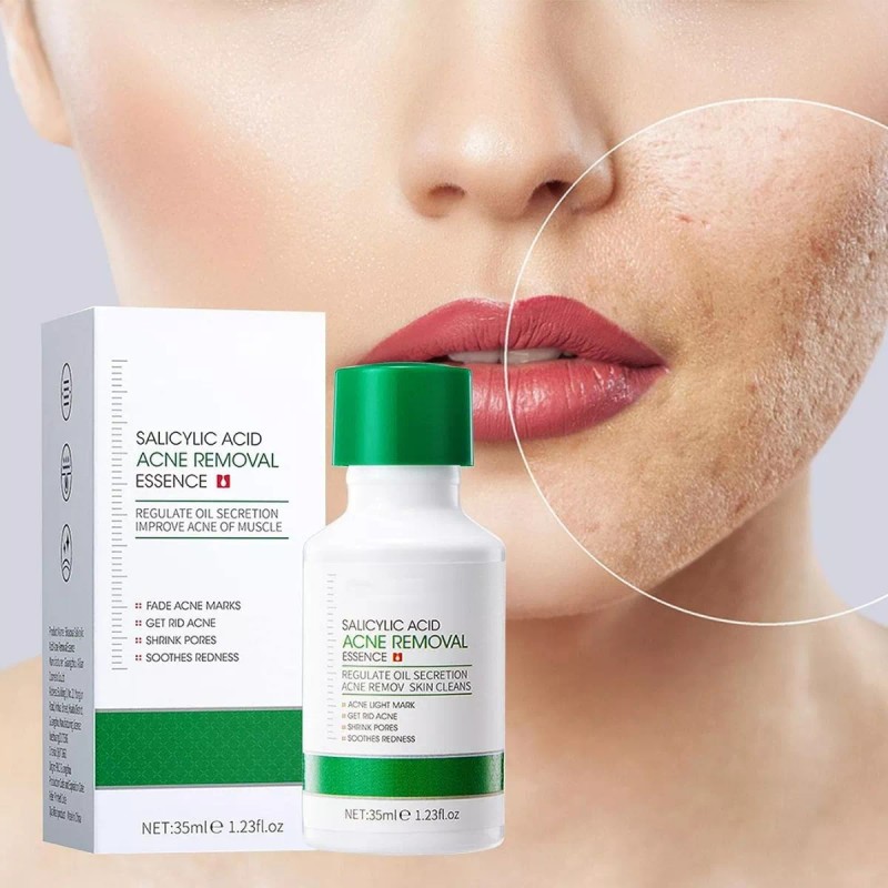 Veraly Liquido Antiacne Serum Reparador Espinillas Acido Salicilico