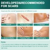 Silicone Scar Sheets,Silicone Scar Tape(1.6"x 120" Roll-3M), Reusable and Effective