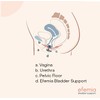 Efemia Bladder Support Device for Women with Stress Urinary Incontinence,