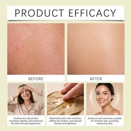 LIGHTEN UP| Crema Honey Turmeric | Crema Aclarante Despigmentante Hidrante | Aclara Manchas y Disminuye la Apariencia de. Arrugas | Con Niacinamida Cú