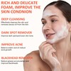 Natural Skin Whitening Soap, Kojic Acid Soap & Turmeric Soap