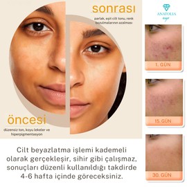 Kojik Asit Sabunu,Koyu Leke, Ölü Hücre, Kolajen, Sivilce, Güneş Lekesi, Zerdeçal, Retinol, C Vitamini, E Vitamini, Kadınlar ve Erkekler için Yüz Temizleyici.