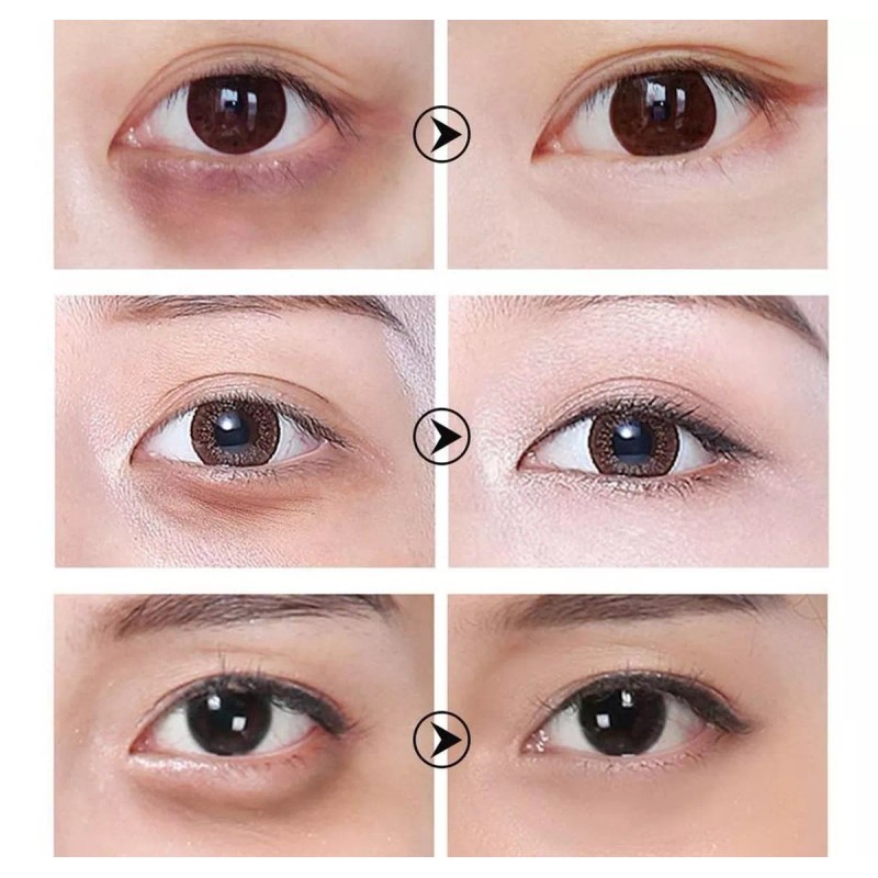 Lanbena Parches Hydrogel Contorno De Ojos Nicotinamida Acido Hialuro