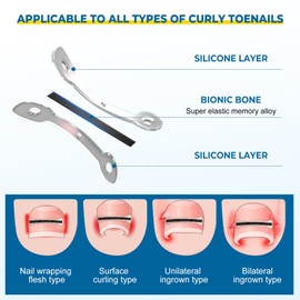Souvik Ingrown Toenail Correction Tool Kit, Nail Correction Clip, Toenail Correction Patch, 180° Bend and Memory Alloy Rebound, for Home Use - Men, Women, 10 Pieces