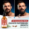 Beard Growth Oil - 2X Concentration Biotin for Men (2