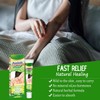 Crema Natural A Base De Hierbas Antipicazón, Crema Para Psoriasis