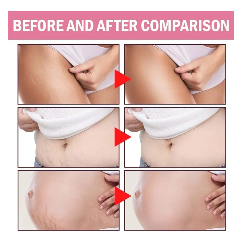 Crema Corporal Reafirmante 300g Anticelulitis Y Estrías Neutra