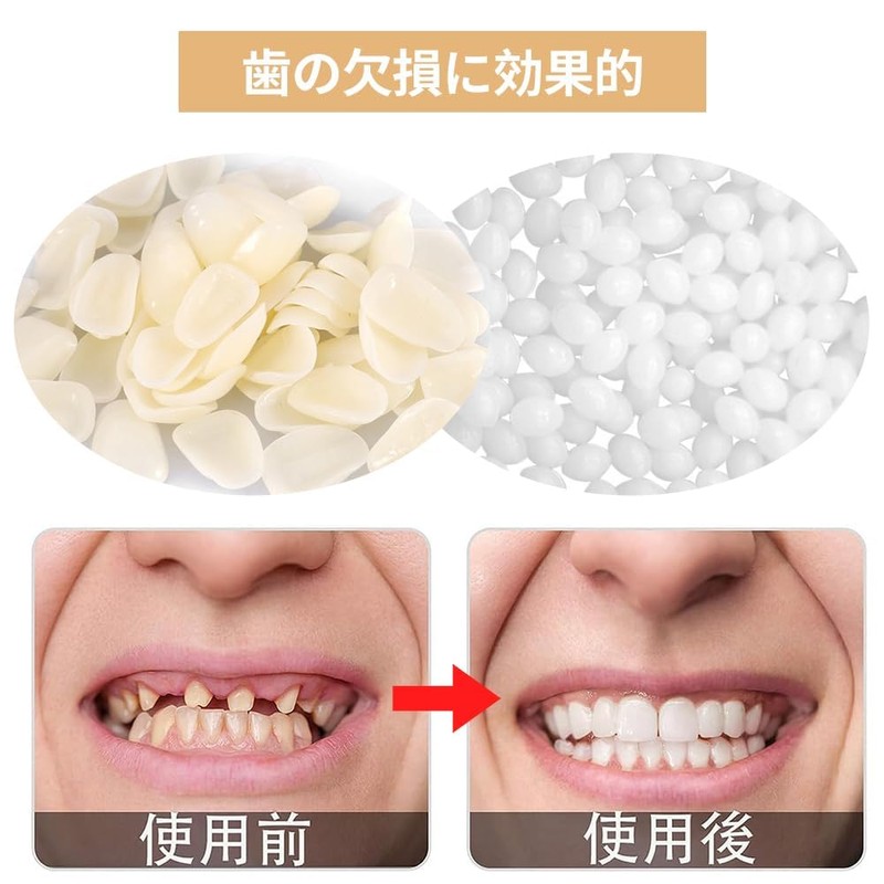 Denture Denture Set of 2 Dental Resin Fitting Beads Teeth