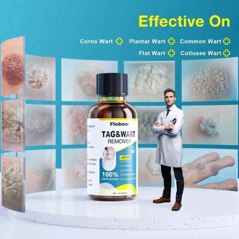 Líquido Para Verrugas 30 Ml - Eliminación Rápida