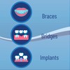 OrVance Threader Floss ­­­- Designed to Floss Through Braces, Bridges,