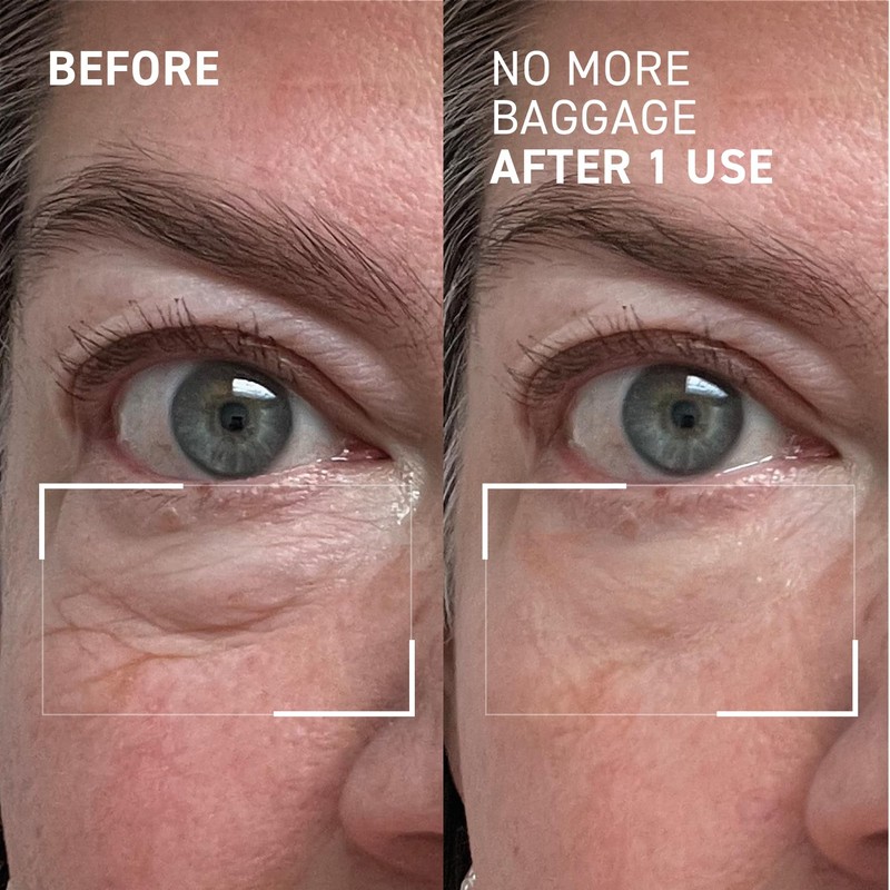 Dr. Brandt Needles No More, No More Baggage - Minimizes