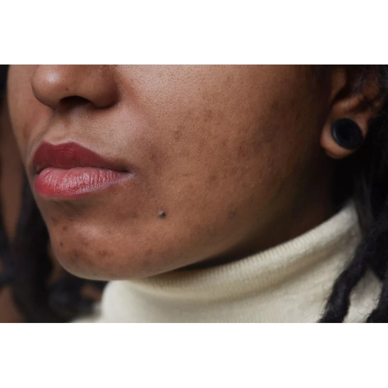 A3 Lemon Face Cream | Brightening & Control Stubborn Blemishes|400