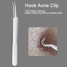 Rnitle Mitesserentferner Komedonenquetscher Set,Edelstahl Akne Whiteheads Mitesser Entferner Kit,Blackhead Remover mit Box aus Edelstahl Akne Whiteheads Mitesser Entferner Kit für alle Hauttypen