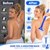 Back Lotion Applicator for Body Care – Foldable Long Handle