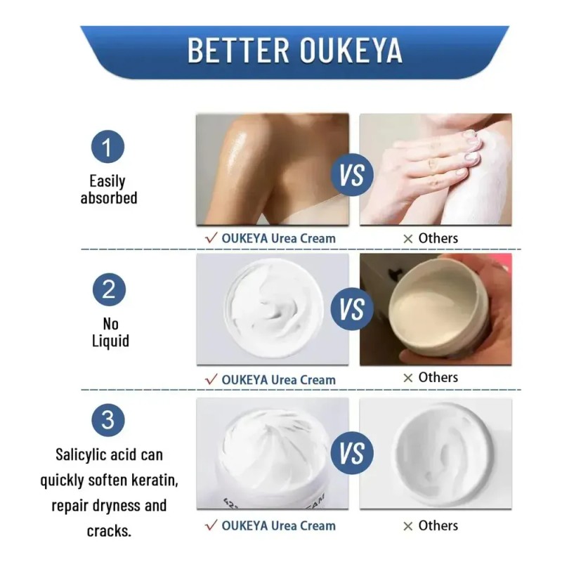 La Crema De Urea Oukeya Hidrata Los Pies Y Las