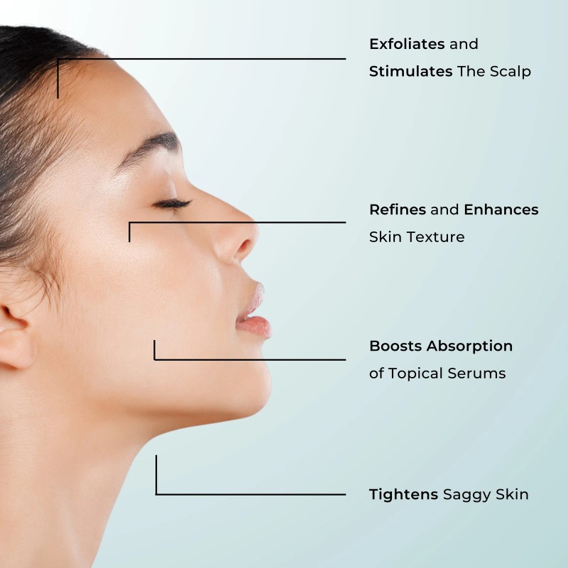 Derma Micro Needle Derma Roller