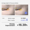 Retinol & Bakuchiol Anti-aging Serum For Wrinkles, Pores,