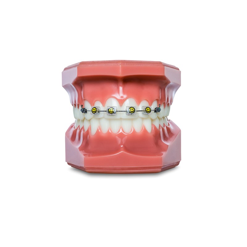 Snapcaps Braces Bumper Cover, Orthodontic Bracket Wax Substitute, Alternative Snap-on