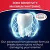 Whites Beaconsfield Teeth Whitening Strips, 60 Strips (30-Day Treatment) –