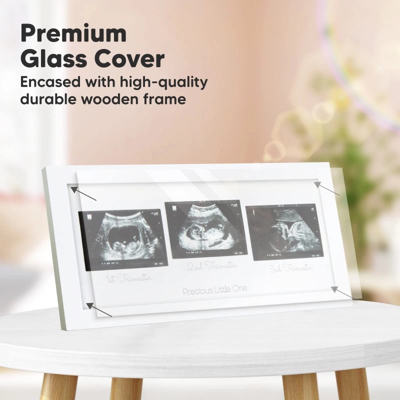 Keababies Baby Sonogram Picture Frames - Trio Ultrasound Pic
