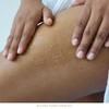 Exfoliante Enzimático Hidrogel 250ml -no Abrasivo