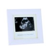 Photo Frame Ultrasound, Echography "Du wirst Oma, Opa, möchtest Du