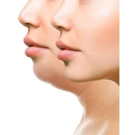 Dtup Kit Reduce Papada Define Mandibula Guasha + Gel + Mentonera
