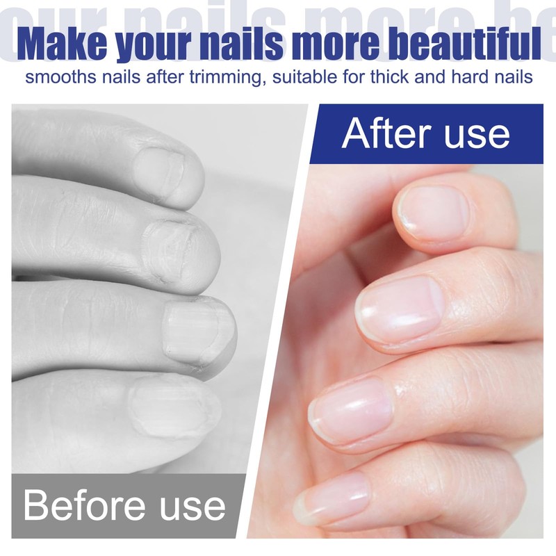 12 Pcs Metal Nail Files, Fingernail Files 3.6’’ Stainless Steel