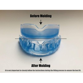 COOLLO SPORTS Boil and Bite - Protector bucal para baloncesto, karate, artes marciales, lucha libre, artes marciales, artes marciales, artes marciales, artes marciales mixtas (funda incluida) - Tamaño adulto (adulto a partir de 11 años)