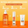 Gel Limpiador Facial Darrow Actine Vitamina C 140g Piel Grasa