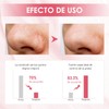 Mascarilla de arcilla Centella Asiática en barra, Soothing Skin,Deep Cleansing,