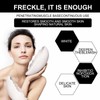 Dark Spot Remover for Face，-Age Spot Remover -Hyperpigmentation Treatment-Sun Spots