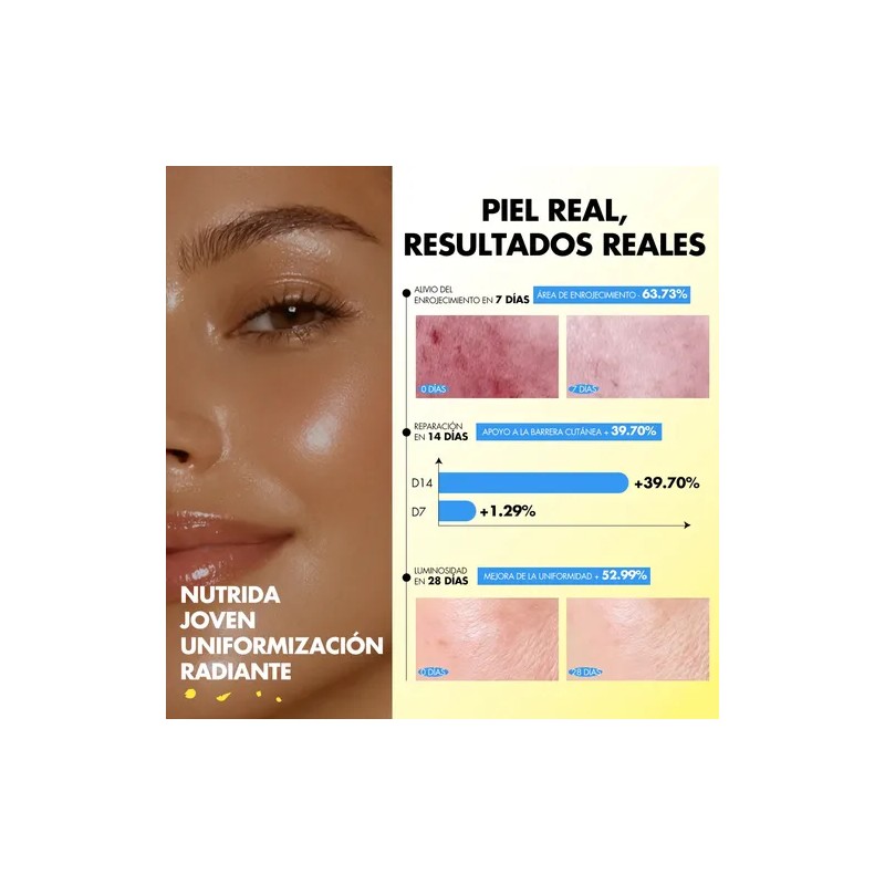 Timmi Beauty Facial Sérum Niacinamida Vitamina C Niacinamide Vitamin C