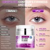 Vbilobec 2025 Latest Caffeine Eye Cream:[30+ SGS Certified] [Used by