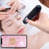 Scalp Detector, 800X Clear Image Hair Folicle Health Analyzer, Hair